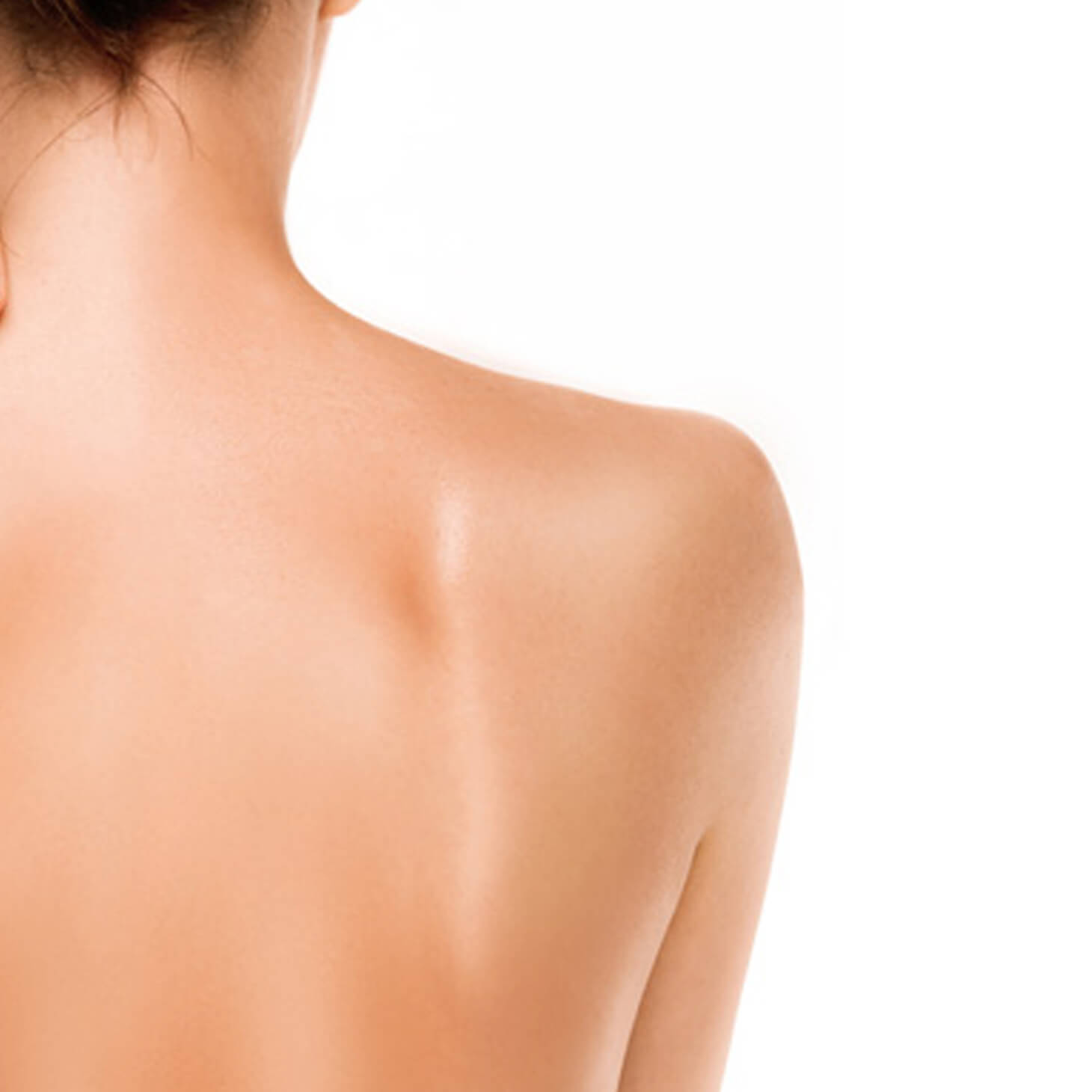 Laser Upper Back Woman